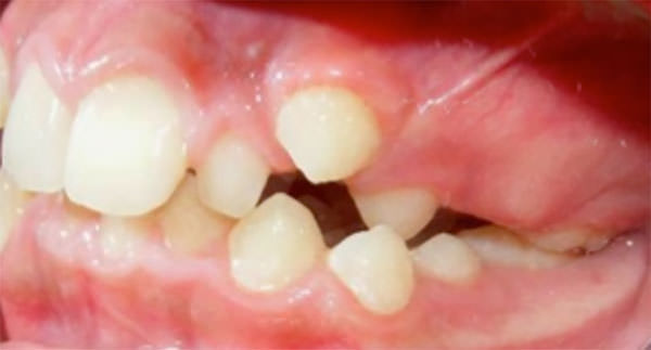 Fig. 6 Lateral izquierda