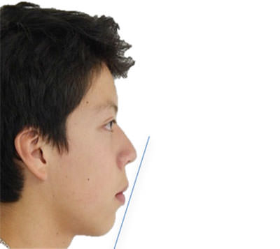 Fig.15 Perfil
