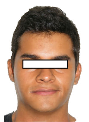 Fig. 1 Paciente aparentemente simétrico