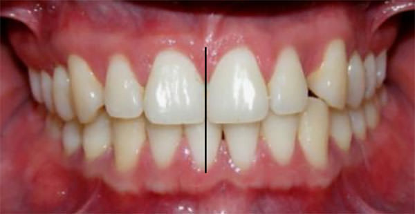 Fig. 3 Frente intraoral