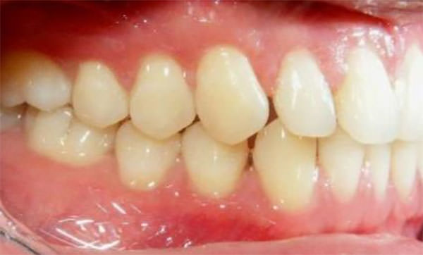 Fig. 4 Intraoral