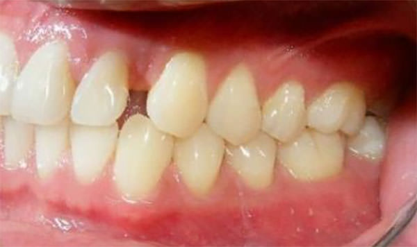 Fig. 5 Izquierdo intraoral