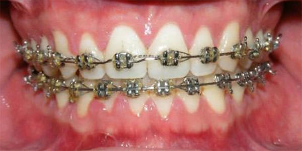 Fig. 8 Intraoral de frente