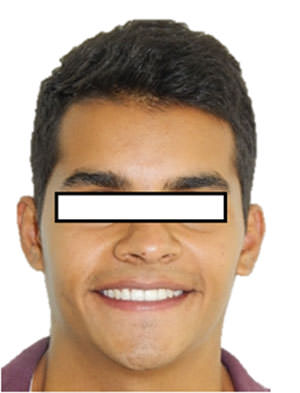 Fig. 13 Frente Sonrisa