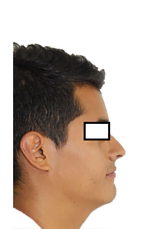 Fig. 14 Perfil