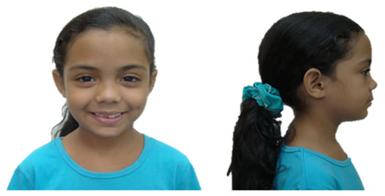 Figura 1 Fotografías Extraorales