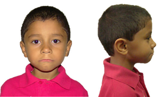 Figura 8 Fotografías Extraorales