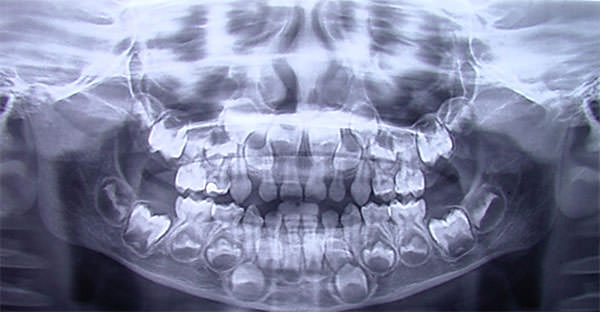 Figura 11 Radiografía panorámica