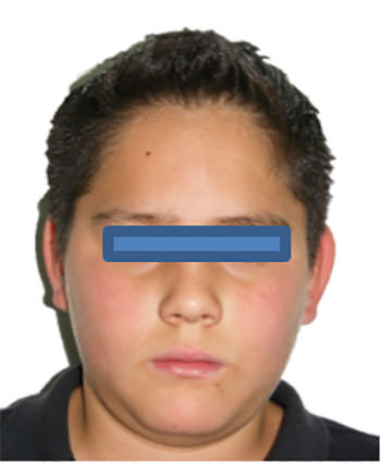 Fig. 1 Frente