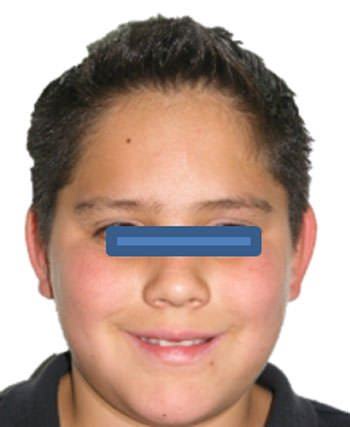 Fig. 2 De sonrisa