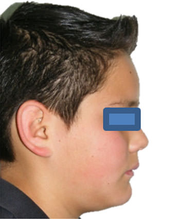 Fig. 3 Perfil