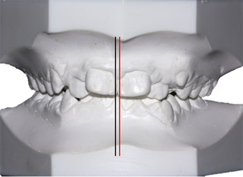 Figura 7 Modelo de frente