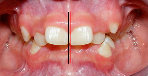Figura 8 Intraoral de frente