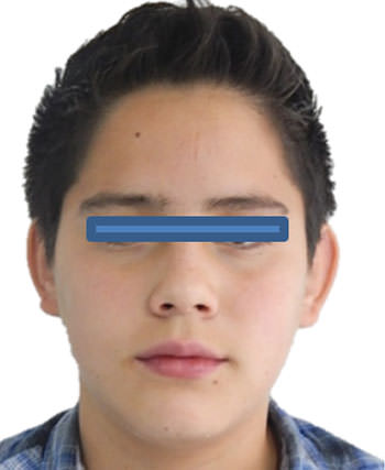 Fig. 15 De frente