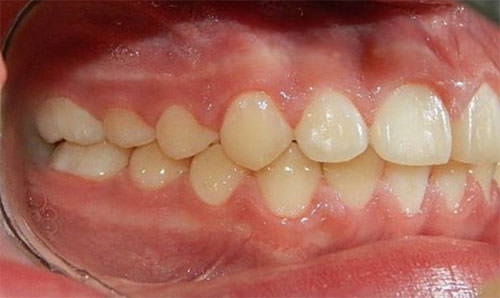 Fig. 19 Lateral derecha