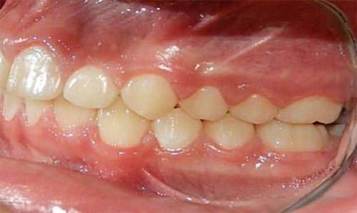 Fig. 20 Lateral izquierda