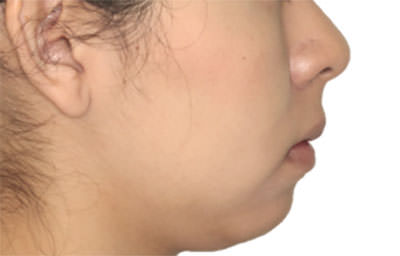 Figura 2 Perfil