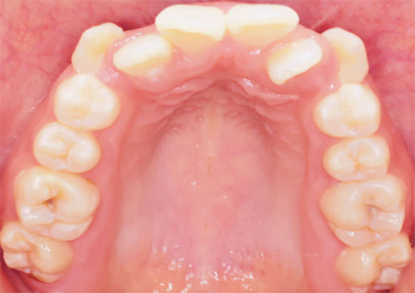 Figura 7 Oclusal Superior