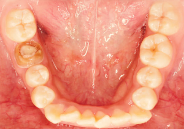 Figura 8 Oclusal Inferior