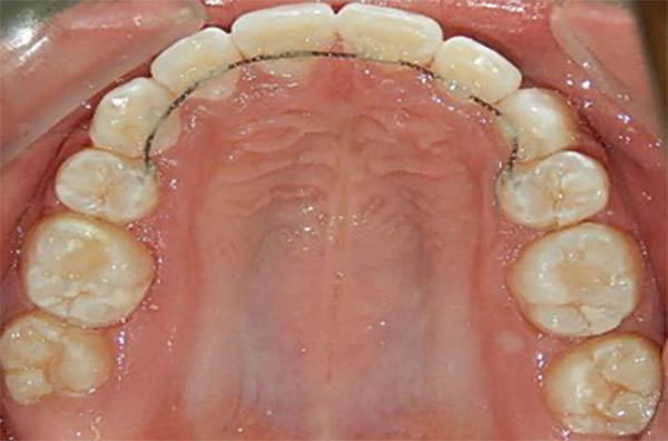 Figura18 Oclusal Superior