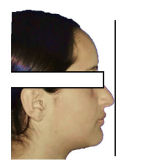Figura 2 Perfil
