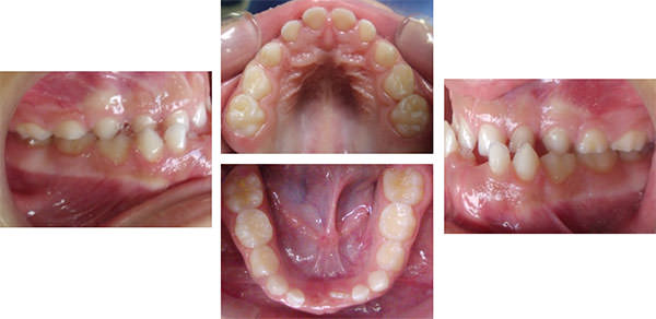 Fig. 3 Fotografías intraorales. Tomado del Postgrado de Odontología Infantil UCV.