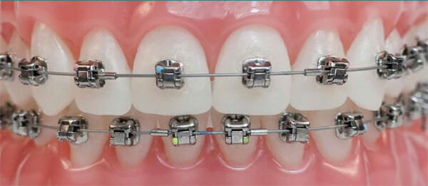 Brackets Damon Q