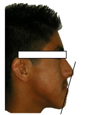 Figura 3 Perfil Derecho