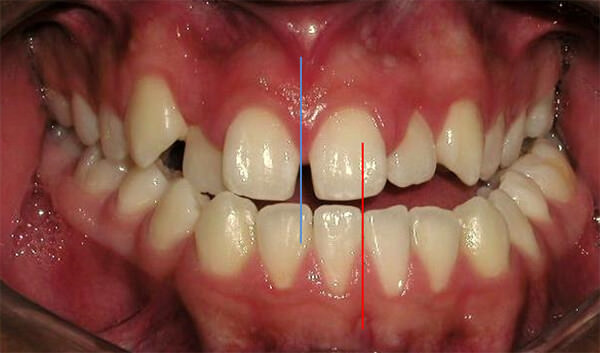 Figura 4 Intraoral de frente