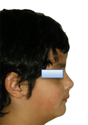 Fig. 2 Perfil