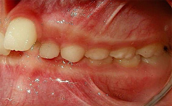 Fig. 4 lateral izquierda