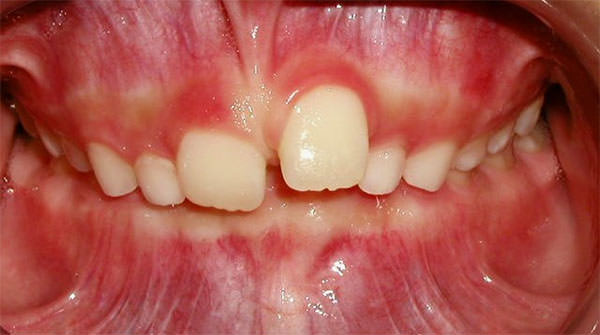 Fig. 5 Frente