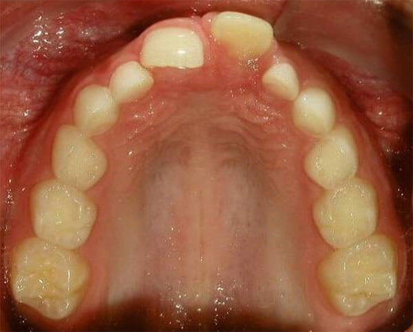Fig. 6 Oclusal superior
