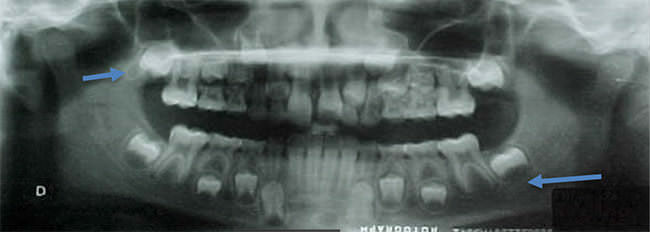 Fig. 9 Rx Panorámica