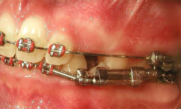 Fig. 12 Izquierda