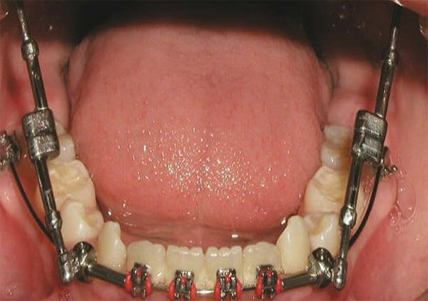 Fig. 15 Inferior