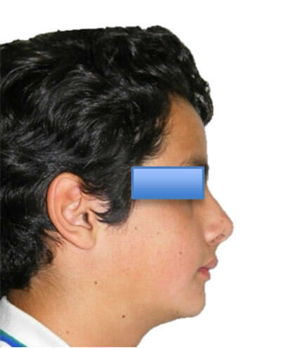 Fig. 20 De perfil