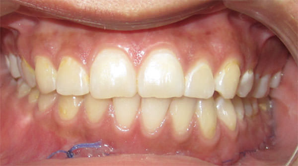 Fig 7 Evaluación oclusal