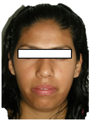 Fig.1 Frente