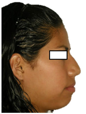 Fig.2 Perfil
