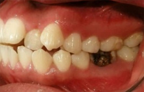 Fig.6 Lateral izquierda