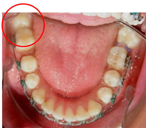 Fig.14 Inferior