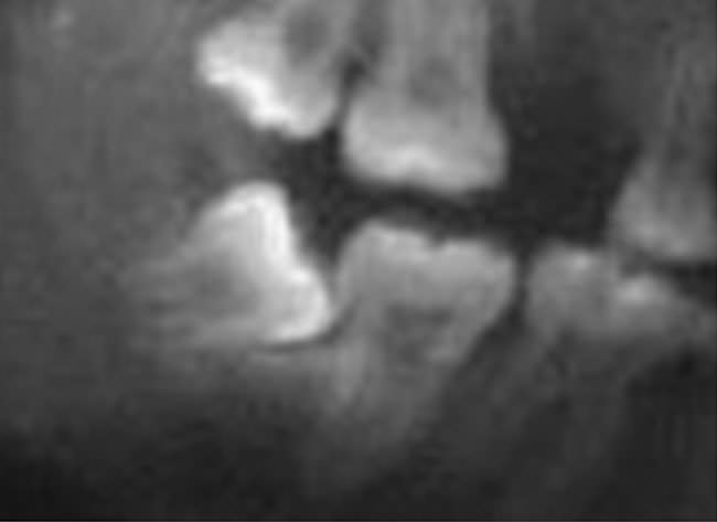 Fig. 15 Inicio