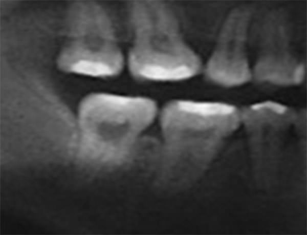 Fig. 18 Final