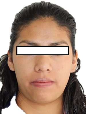 Fig.19 Frente