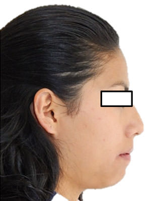 Fig.20 Perfil