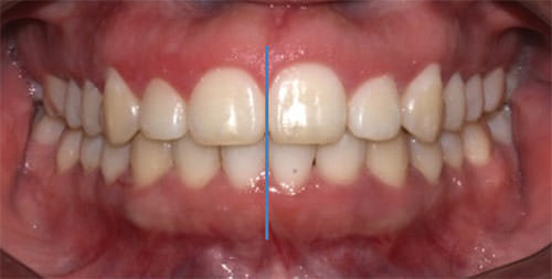 Fig.23 Frente