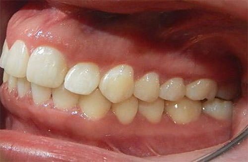 Fig.24 Lateral izquierda