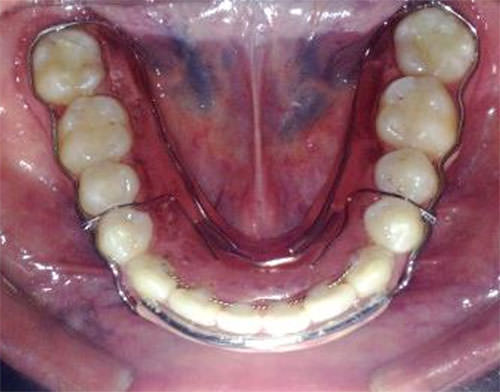 Fig.29 Inferior
