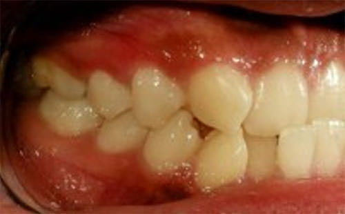 Fig. 3 Lateral derecha